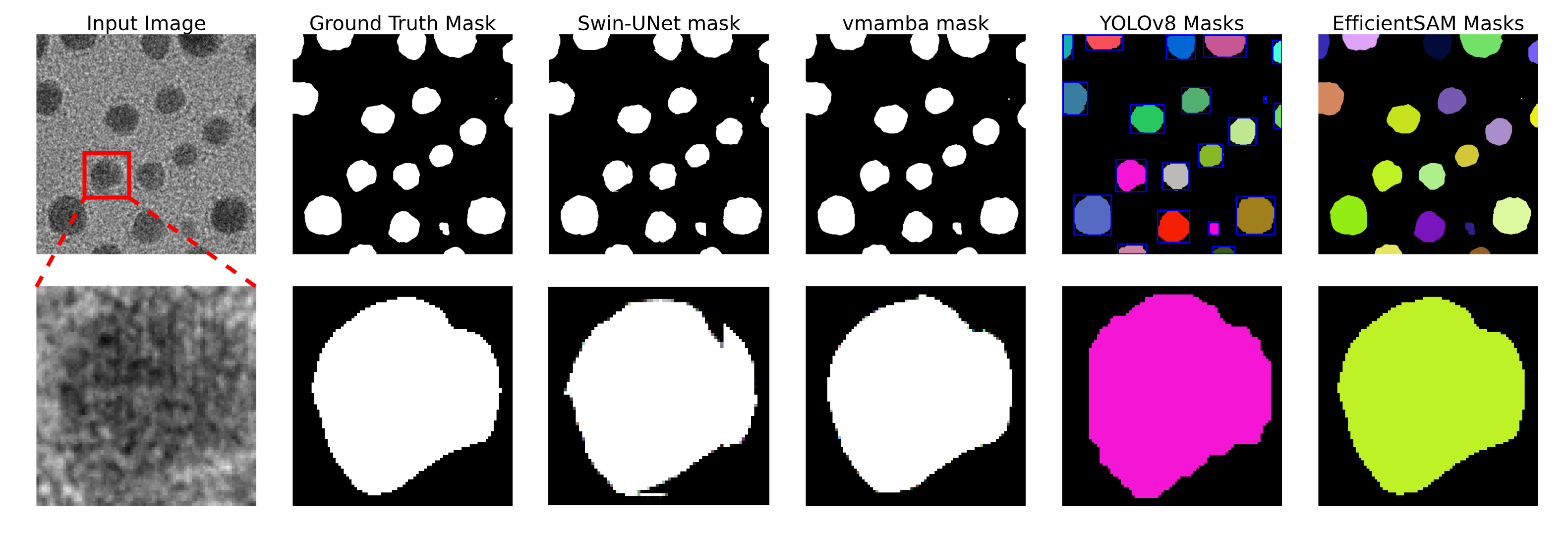 Comparison of different segmentation methods. Left: input image and zoomed-in area. Then, segmentation results of Ground Truth, Swin-UNet, VMamba, YOLOv8, and EfficientSAM.